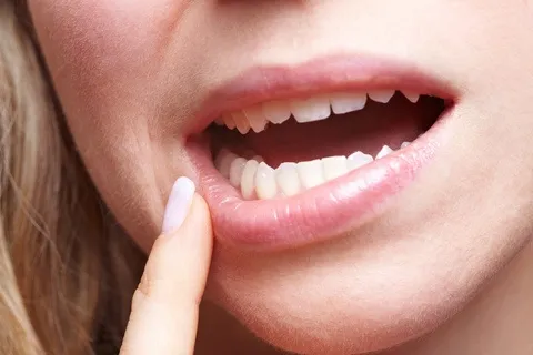 Inflamações generalizadas com as raízes abertas