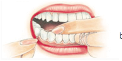 como passar o fio dental corretamente